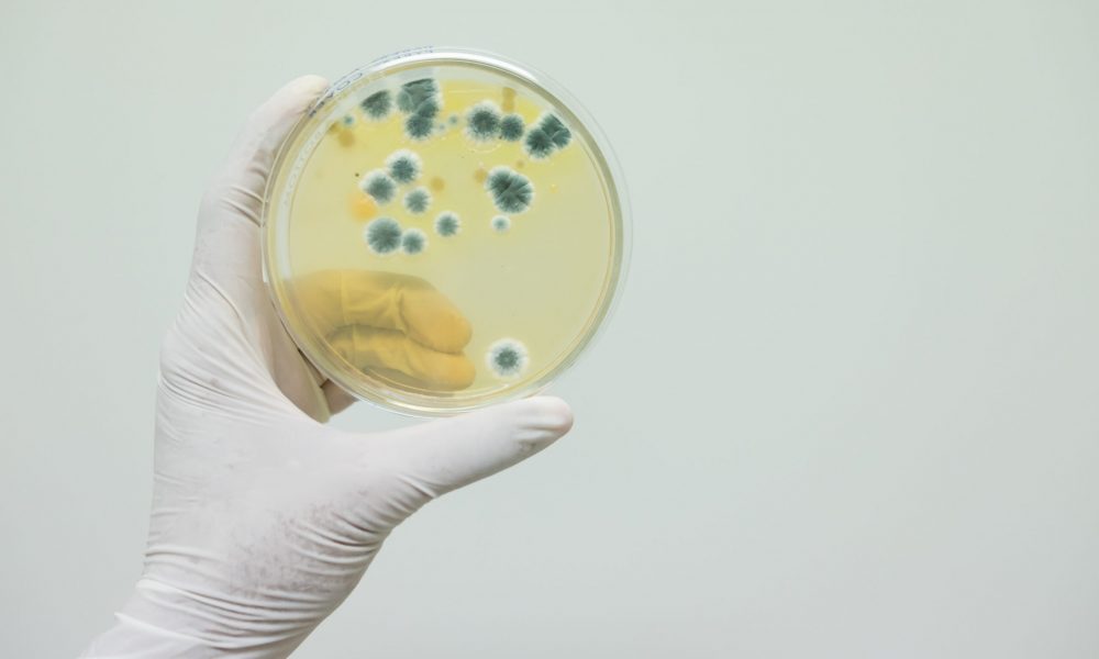 the-microbiologist-hand-wear-white-sterile-glove-i-2023-11-27-04-53-38-utc (1)